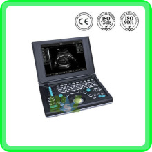 MSLVU06 laptop vet ultrasound scanner